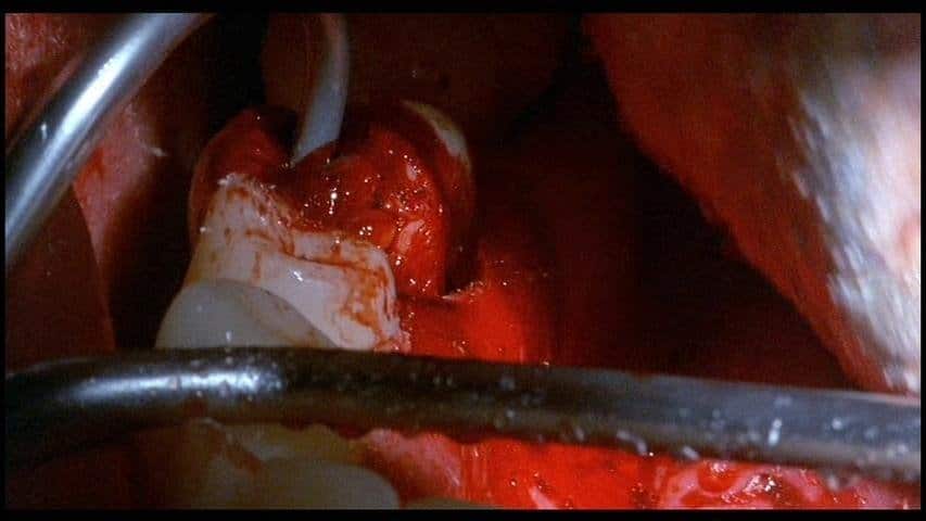 The Dentist 2 – Zahnarzt des Schreckens - Film 1998 - Scary-Movies.de